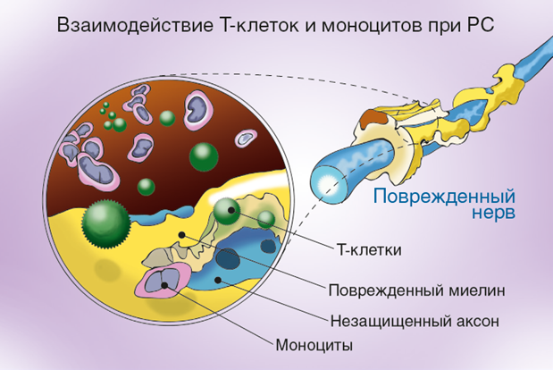 Взаимодействие T-клеток и моноцитов при РС