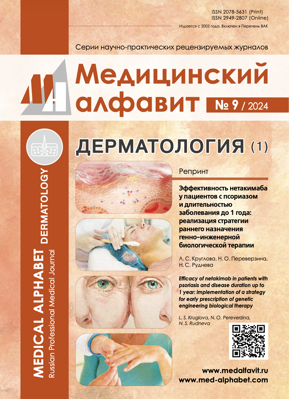 Эффективность нетакимаба у пациентов с псориазом и длительностью заболевания до 1 года: реализация стратегии раннего назначения генно-инженерной биологической терапии