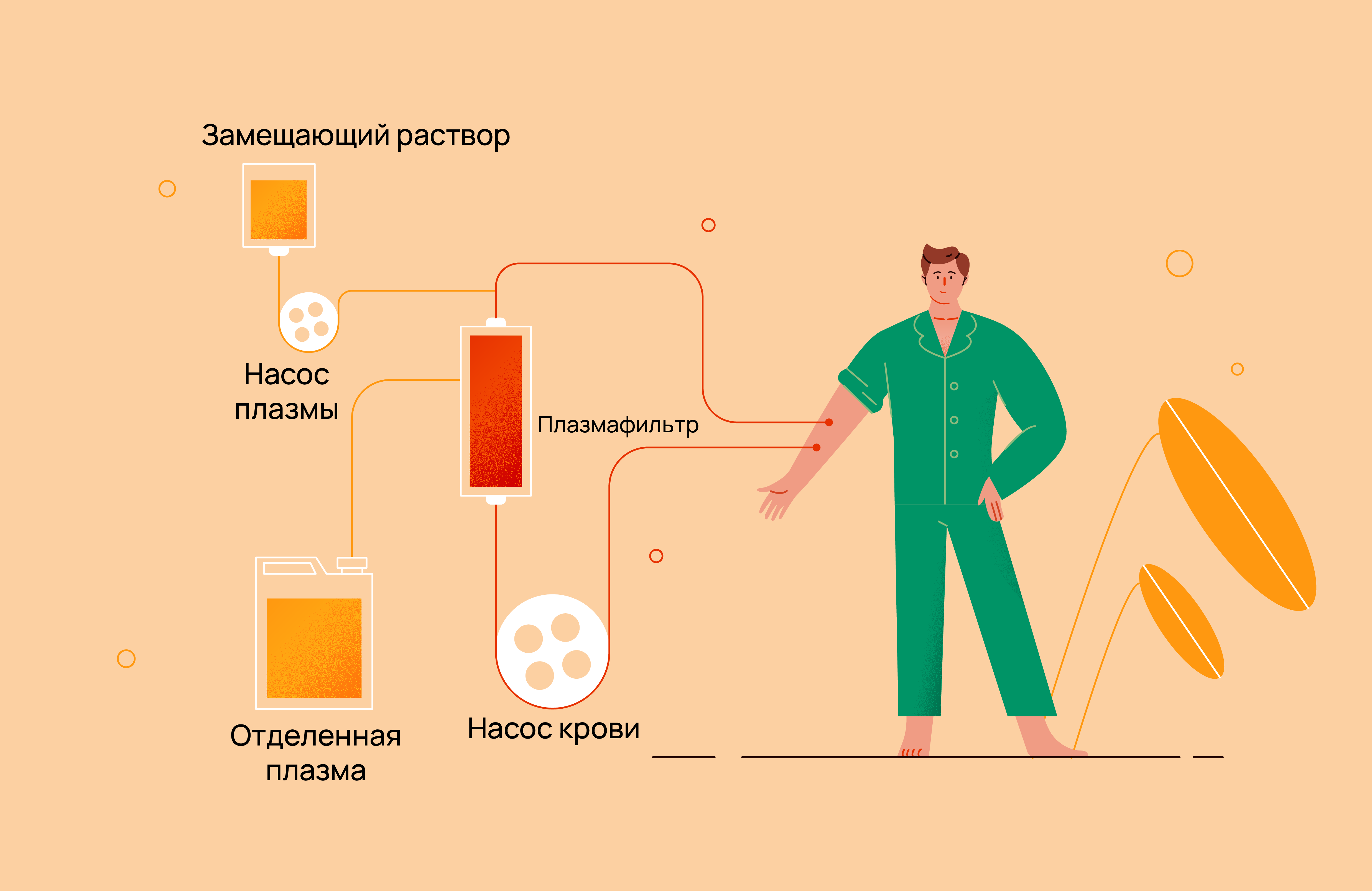 Понятие о плазмаферезе